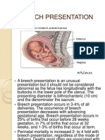 Breech Presentation