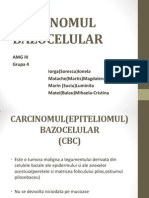 Carcinomul Bazocelular