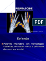 Aula - Artrite Reumatoide