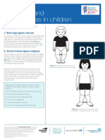 Bow Legs and Knock Knees in Children: Orthopaedic Fact Sheet
