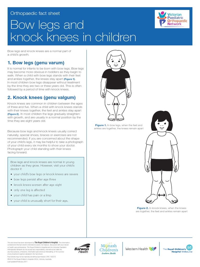 Bow Legs and Knock Knees in Children: Orthopaedic Fact Sheet | PDF ...