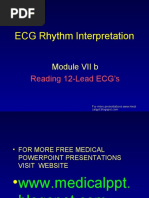Download ECG Rhythm Interpretation by vanstar7 SN21545916 doc pdf