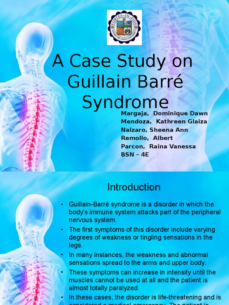 Cp Guillain Barre Syndrome Axon Neuron