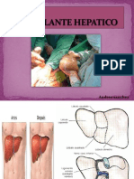 Trasplante Hepatico