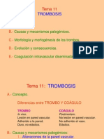 Trombosis: Causas y Tipos de Trombos