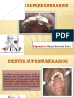 Dientes Supernumerarios