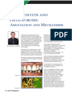 Osteoporois and Periodontitis