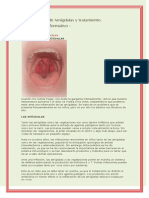 Inflamación de Amígdalas y Tratamiento