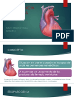 Insuficiencia Cardiaca