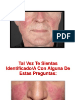 Como Curar La Rosacea - Piel Con Rosacea, Rosacea Tratamiento Casero