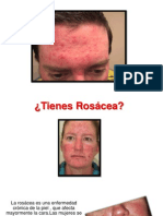 Rosacea Fotos - Remedios Caseros Para La Rosacea, Dermatologia Rosacea