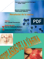 Neoplasia Vaginal