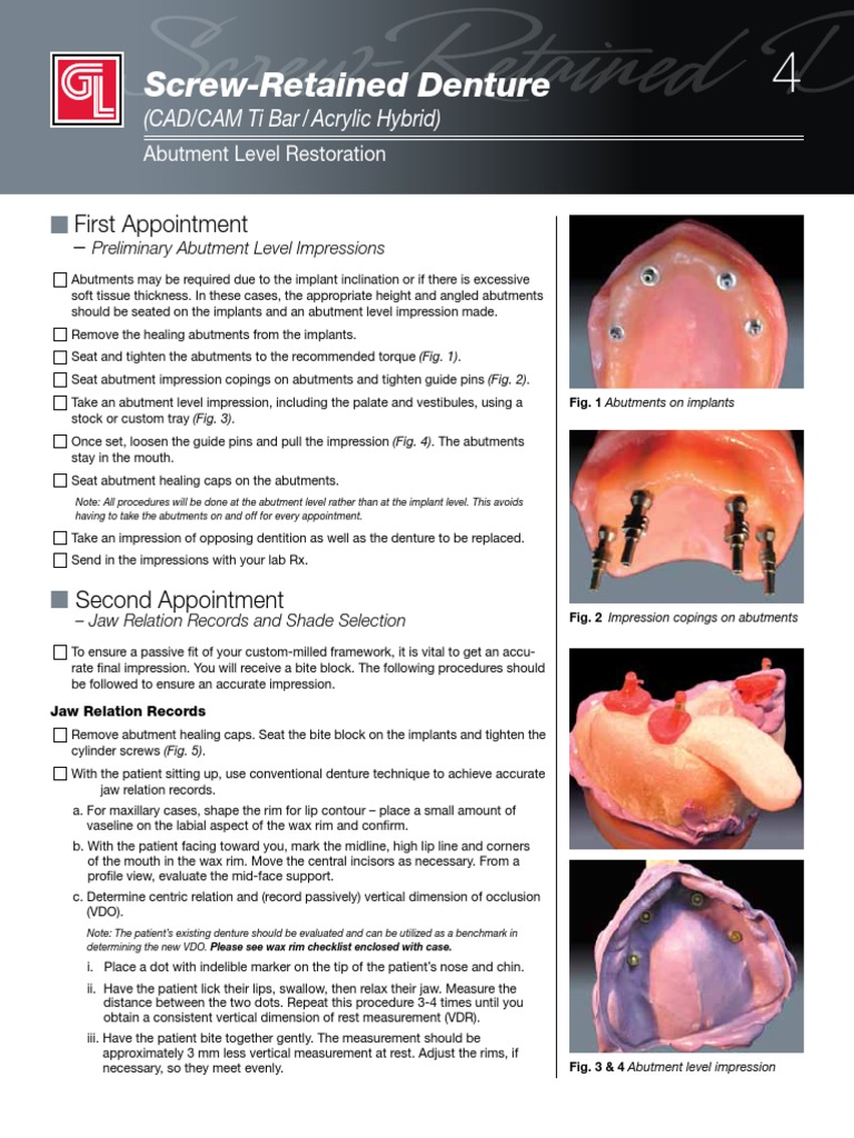 Screw Retained Abutment Level Dental Implant Dentures