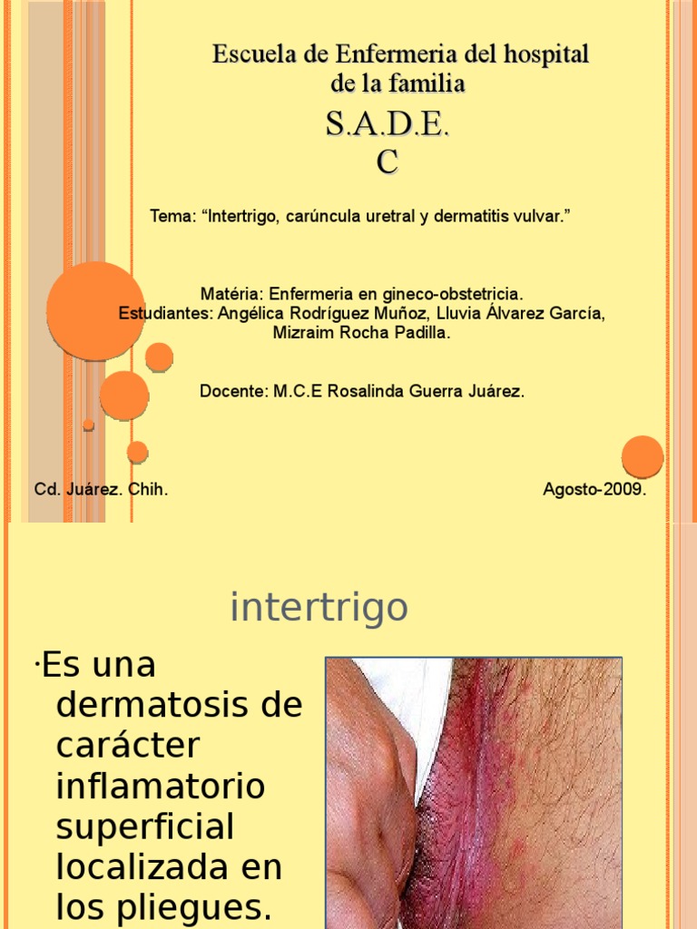 Intertrigo Inguinal Forum _ Comment Soigner L’Intertrigo – ACTNCI