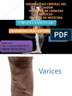 Varices