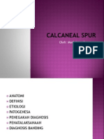 Calcaneal Spur Print