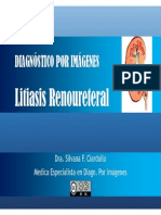 Diagnostico de Litiasis Renoureteral