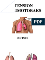 PNEUMOTORAKS