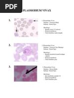 Download Plasmodium Vivax Dan Falciparum 1 by Adelia Putri Sabrina SN217253008 doc pdf