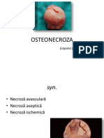 Osteonecroza capului femural