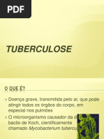 Tuberculose