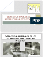 Terceros Molares Superiores