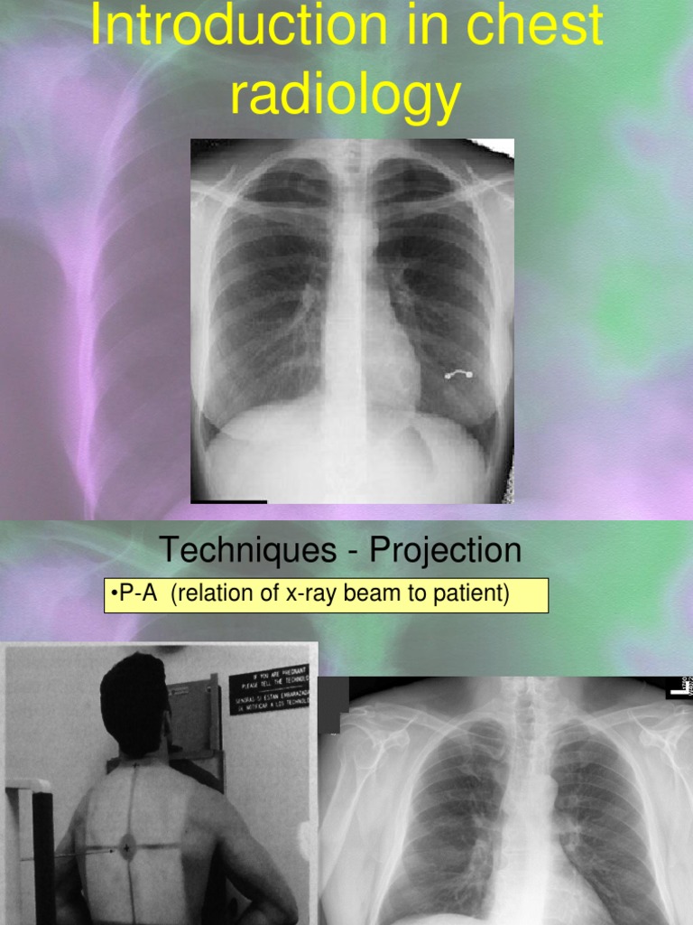 Chest Radiology Techniques Overview | PDF | Thorax | Lung