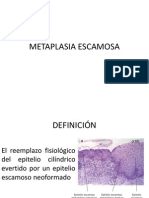 Metaplasia escamosa: Reemplazo del epitelio cilíndrico por escamoso