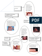 Candidiasis Mapa