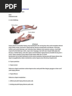 Download Askep Kejang Demam Pada Anak by Randy Junior SN217866924 doc pdf