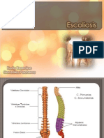 escoliosis1-120226150841-phpapp01