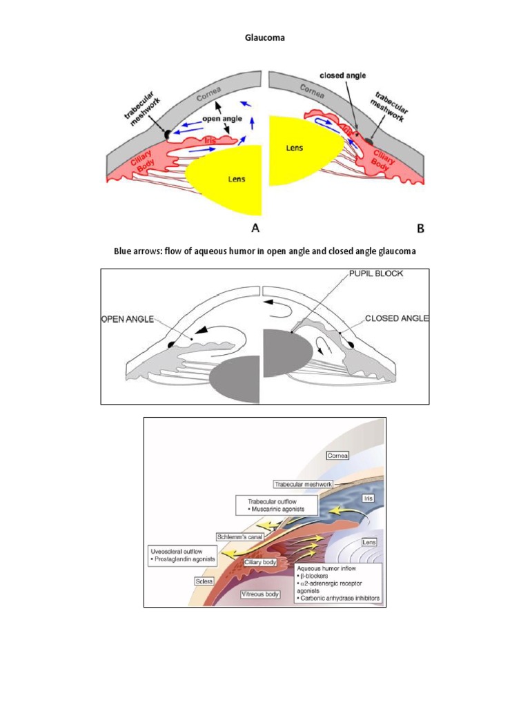 Blue Arrows: Flow of Aqueous Humor in Open Angle and Closed Angle ...