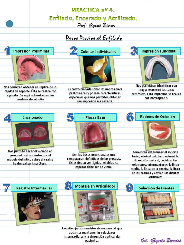 ENFILADO | Dentadura postiza | Diente humano