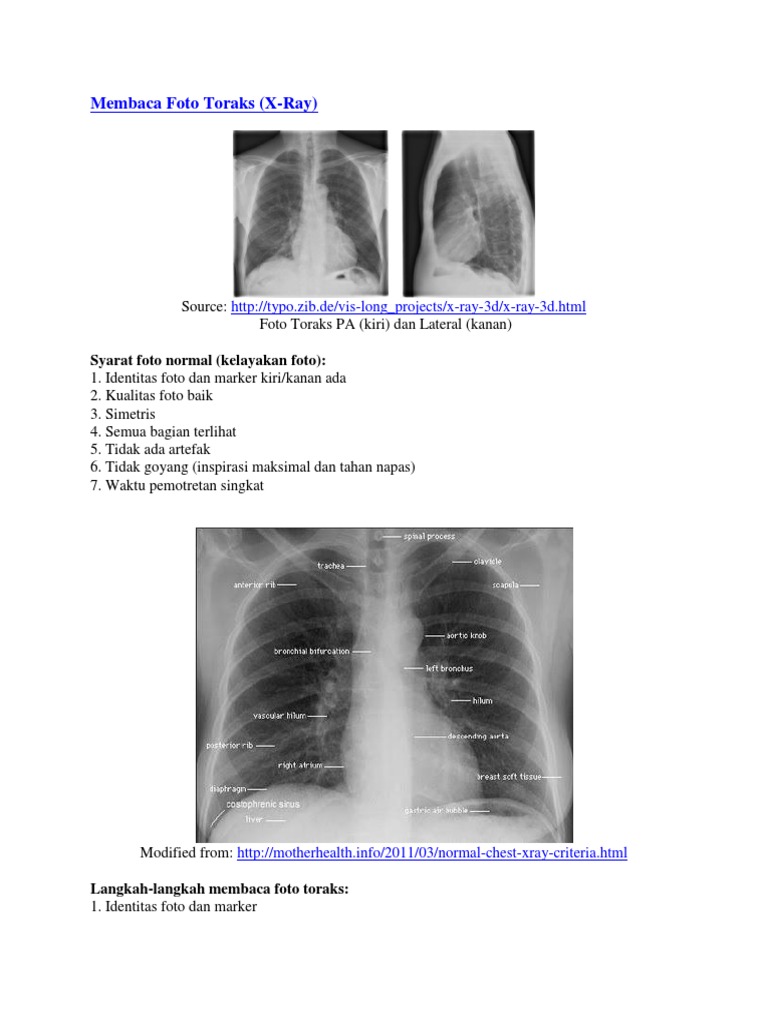 Panduan Membaca Foto Toraks X-Ray | PDF | Sains & Matematika
