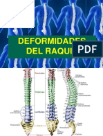 Unidad 3.2 Deformidades Del Raquis