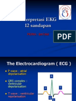 Ekg