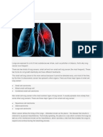 Lung Cancer Hospital | Lung Cancer Treatment | Treatment of Lung Cancer in india