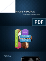 Esteatosis Hepatica