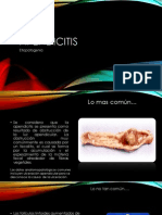 Apendicitis