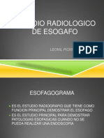 Estudio radiológico del esófago: esofagograma