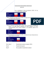 Clasificacion de Recesiones Gingivales