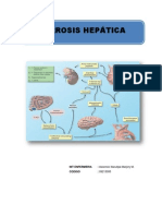 Encefalopatia Hepatica