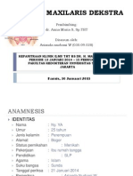 Sinusitis Maksilaris Dekstra