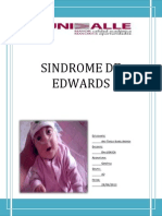 Sindrome de Edwards