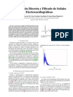 Reducción ruido ECG