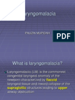 Laryngomalacia: Diagnosis and Management