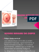 Lesiones Benignas Del Cervix