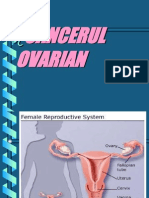 Cancerul Ovarian
