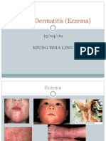 Atopic Dermatitis (Eczema)