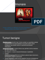 Tumori pulmonare 2